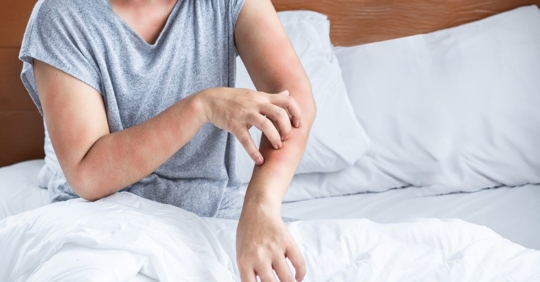 woman itching from bed bugs