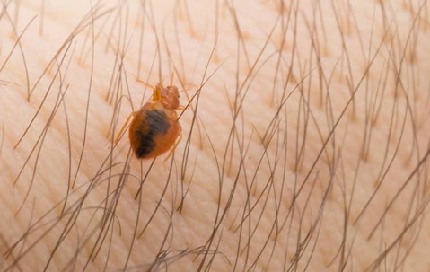 a bed bug crawling on human skin